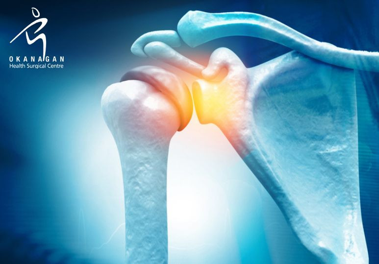 What Is Arthroscopic Shoulder Surgery?